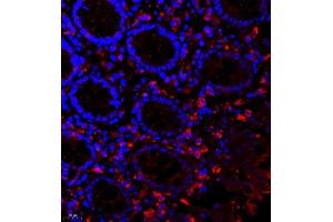 Immunofluorescence of paraffin embedded human colon using scr3 (ABIN7074886) at dilution of 1:2000 (400x lens) (NCOA3 抗体)