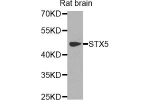 Western blot analysis of extracts of rat brain cells, using STX5 antibody. (Syntaxin 5 抗体)