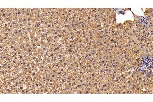 Detection of LPL in Rat Liver Tissue using Polyclonal Antibody to Lipoprotein lipase (LPL) (Lipoprotein Lipase 抗体  (AA 28-474))