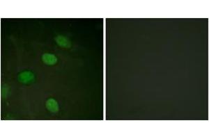 Immunofluorescence analysis of HeLa cells, using c-Jun (Phospho-Thr231) Antibody.