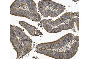 IHC analysis of UNG using anti UNG antibody (ABIN7602695). (UNG 抗体  (AA 96-313))