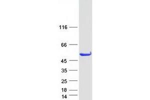 Western Blotting (WB) image for STAM Binding Protein (STAMBP) (Transcript Variant 1) protein (Myc-DYKDDDDK Tag) (ABIN2712375)