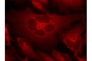 Immunofluorescence staining of methanol-fixed Hela cells using Bcr(Ab-177) Antibody. (BCR 抗体)