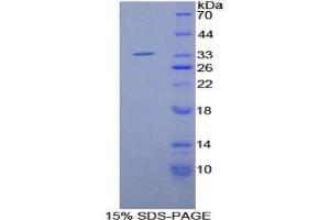 SDS-PAGE analysis of Rat Matrix Metalloproteinase 7 (MMP7) Protein. (MMP7 蛋白)