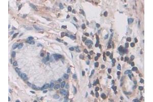 Immunohistochemistry (IHC) image for anti-Cofilin 1 (CFL1) (AA 3-161) antibody (ABIN7433783)