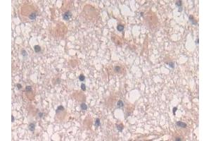 Immunohistochemistry (IHC) image for anti-Interleukin 10 (IL10) (AA 19-178) antibody (ABIN7442330)