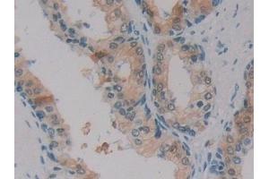 Immunohistochemistry (IHC) image for anti-Sorbitol Dehydrogenase (SORD) (AA 98-355) antibody (ABIN7433702)