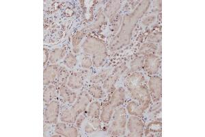 Immunohistochemical analysis of (ABIN391458 and ABIN2841434) on paraffin-embedded Human kidney tissue.