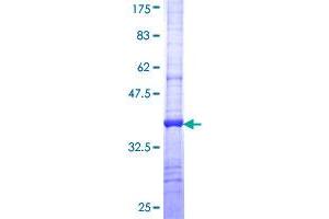 SLC6A5 Protein (AA 294-393) (GST tag)