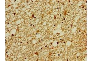 Immunohistochemistry of paraffin-embedded human brain tissue using ABIN7176339 at dilution of 1:100 (ZNF488 抗体  (AA 1-200))