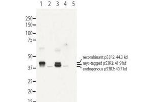 Image no. 1 for anti-Ribonucleotide Reductase M2 B (TP53 Inducible) (RRM2B) (N-Term) antibody (ABIN1104077) (RRM2B 抗体  (N-Term))