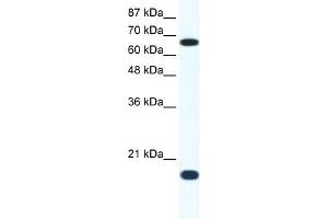 Western Blot showing CUL1 antibody used at a concentration of 1-2 ug/ml to detect its target protein.
