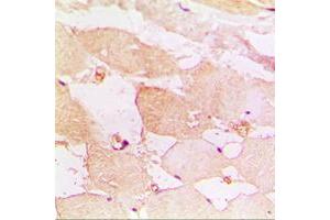 Immunohistochemical analysis of CD183 staining in human muscle formalin fixed paraffin embedded tissue section. (CXCR3 抗体  (Center))