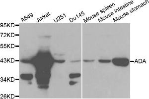 Western blot analysis of extracts of various cell lines, using ADA antibody. (ADA 抗体)