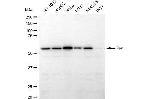 Western blotting analysis using fyn antibody (ABIN7798671).