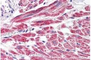 Human Heart (formalin-fixed, paraffin-embedded) stained with SNAI2 antibody ABIN214479 at 2. (SLUG 抗体  (Internal Region))
