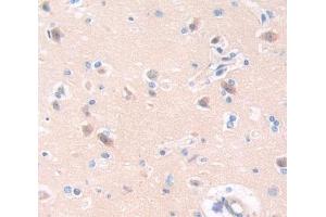 Immunohistochemistry (IHC) image for anti-Neurotrophic Tyrosine Kinase, Receptor, Type 2 (NTRK2) (AA 32-430) antibody (ABIN7443689)