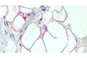Immunohistochemistry of paraffin-embedded Adipose Tissue using DCBLD2 Polyclonal Antibody at dilution of 1:50. (DCBLD2 抗体)