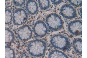 Detection of GLa in Human Rectum Tissue using Polyclonal Antibody to Galactosidase Alpha (GLa) (GLA 抗体  (AA 1-80))