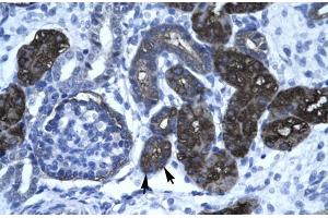 Human kidney; DKFZP761C169 antibody - N-terminal region in Human kidney cells using Immunohistochemistry (GC-Rich Promoter Binding Protein 1 (GPBP1) (N-Term) 抗体)