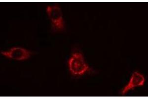 ABIN6269089 staining HeLa cells by IF/ICC.