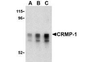 Western blot analysis of CRMP1 in Caco-2 cell lysate with AP30243PU-N CRMP1 antibody at (A) 1, (B) 2 and (C) 4 μg/ml. (CRMP1 抗体  (Intermediate Domain))