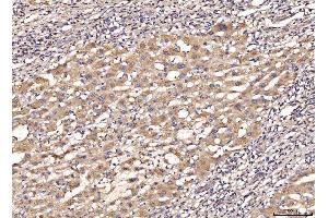 IHC analysis of MYD88 using anti-MYD88 antibody (ABIN7602189).