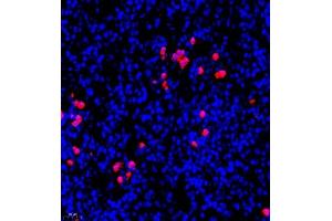 Immunofluorescence (Paraffin-embedded Sections) (IF (p)) image for anti-S100 Calcium Binding Protein A9 (S100A9) antibody (ABIN7075497)