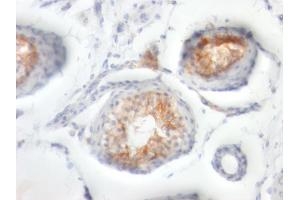 Immunohistochemistry (IHC) image for anti-Basigin (Ok Blood Group) (BSG) antibody (ABIN6940676)
