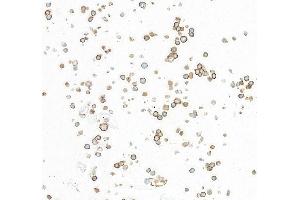 Immunocytochemistry (ICC) image for anti-CD86 (CD86) (AA 24-245) antibody (ABIN7795646) (Recombinant CD86 抗体  (AA 24-245))