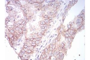 Immunohistochemistry (IHC) image for anti-Potassium Intermediate/small Conductance Calcium-Activated Channel, Subfamily N, Member 2 (KCNN2) (AA 36-52) antibody (ABIN5542523)