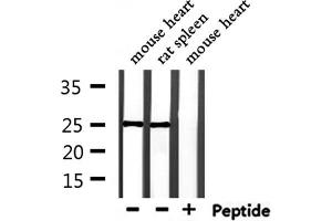 Western blot analysis of extracts from mouse heart and rat spleen, using RAB28 Antibody. (RAB28 抗体  (Internal Region))