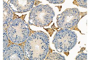 ABIN6264044 and ABIN6273287 at 1/100 staining Mouse testis tissue by IHC-P.