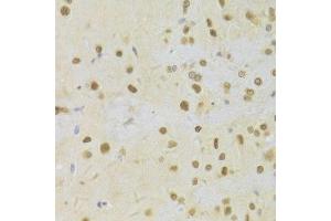 Immunohistochemistry of paraffin-embedded rat brain using HDGF Antibody. (HDGF 抗体  (AA 1-240))