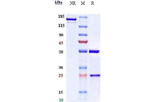 Anti- Human/Mouse/Monkey CTGF( Pamrevlumab) In Vivo Mab on SDS-PAGE under reducing (R) condition. (Recombinant CCN2 (Pamrevlumab Biosimilar) 抗体)