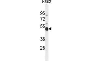Western Blotting (WB) image for anti-NME Gene Family Member 9 (NME9) antibody (ABIN2995969) (NME9 抗体)