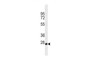 MED22 Antibody (N-term) (ABIN656595 and ABIN2845856) western blot analysis in HL-60 cell line lysates (35 μg/lane). (MED22 抗体  (N-Term))