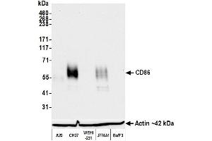 Western Blotting (WB) image for anti-CD86 (CD86) (AA 24-245) antibody (ABIN7795646) (Recombinant CD86 抗体  (AA 24-245))