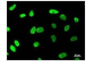 Immunostaining analysis in HeLa cells. (MATR3 抗体)