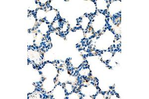 Immunohistochemistry of paraffin embedded mouse lung using P4H (ABIN7074215) at dilution of 1:700 (400x lens) (HIF Prolyl Hydroxylase 抗体)