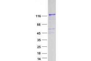 Validation with Western Blot (FGD1 Protein (Myc-DYKDDDDK Tag))