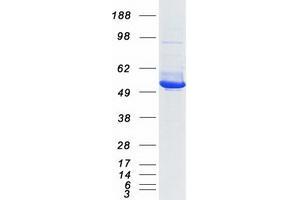 Western Blotting (WB) image for Isocitrate Dehydrogenase 2 (NADP+), Mitochondrial (IDH2) protein (Myc-DYKDDDDK Tag) (ABIN2723856)