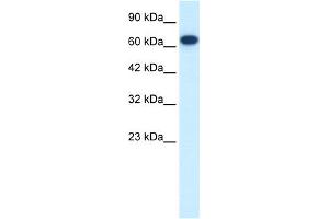 WB Suggested Anti-FLJ37300 Antibody Titration:  0. (KIF19 抗体  (N-Term))