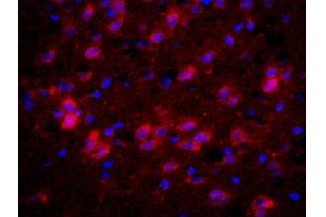 Formalin-fixed and paraffin-embedded rat brain labeled with Anti-CHRM4/mAChR M4 Polyclonal Antibody, Unconjugated (ABIN1387838) 1:200, overnight at 4°C, The secondary antibody was Goat Anti-Rabbit IgG, PE conjugated used at 1:200 dilution for 40 minutes at 37°C. (CHRM4 抗体  (AA 1-31))