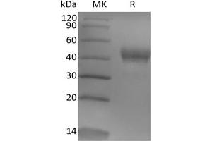 Western Blotting (WB) image for Tumor-Associated Calcium Signal Transducer 2 (TACSTD2) (Active) protein (His tag) (ABIN7319882)