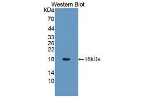 Detection of Recombinant CD7, Mouse using Polyclonal Antibody to Cluster Of Differentiation 7 (CD7) (CD7 抗体  (AA 24-150))