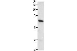 Western Blotting (WB) image for anti-Frizzled Family Receptor 4 (FZD4) antibody (ABIN2428931) (FZD4 抗体)