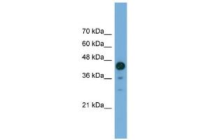 WB Suggested Anti-C2orf62 Antibody Titration: 0. (C2orf62 抗体  (C-Term))