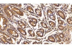 Detection of Surv in Porcine Small intestine Tissue using Monoclonal Antibody to Survivin (Surv) (Survivin 抗体  (AA 1-142))