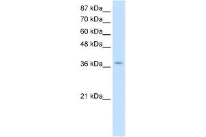 WB Suggested Anti-ZNF550 Antibody Titration:  2. (ZNF550 抗体  (Middle Region))